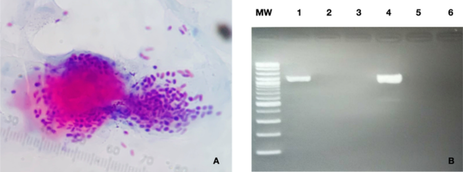 Clinical characteristics, progression patterns and treatment outcomes in microsporidial keratoconjunctivitis: a prospective study in Thailand