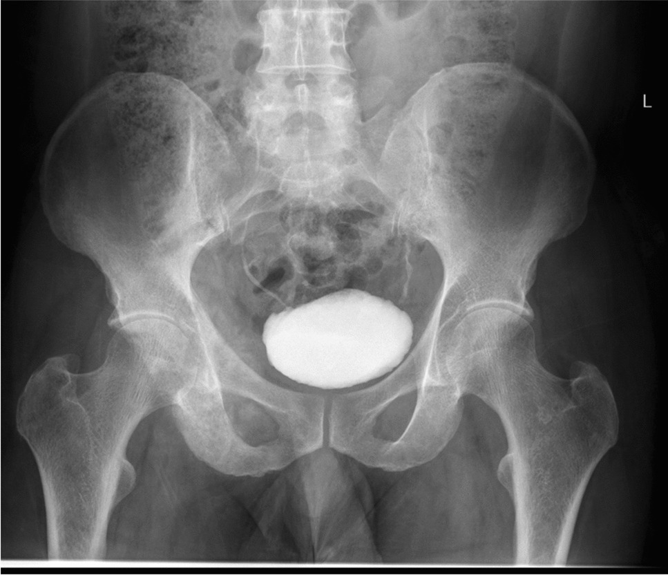 Question: Painful right hip