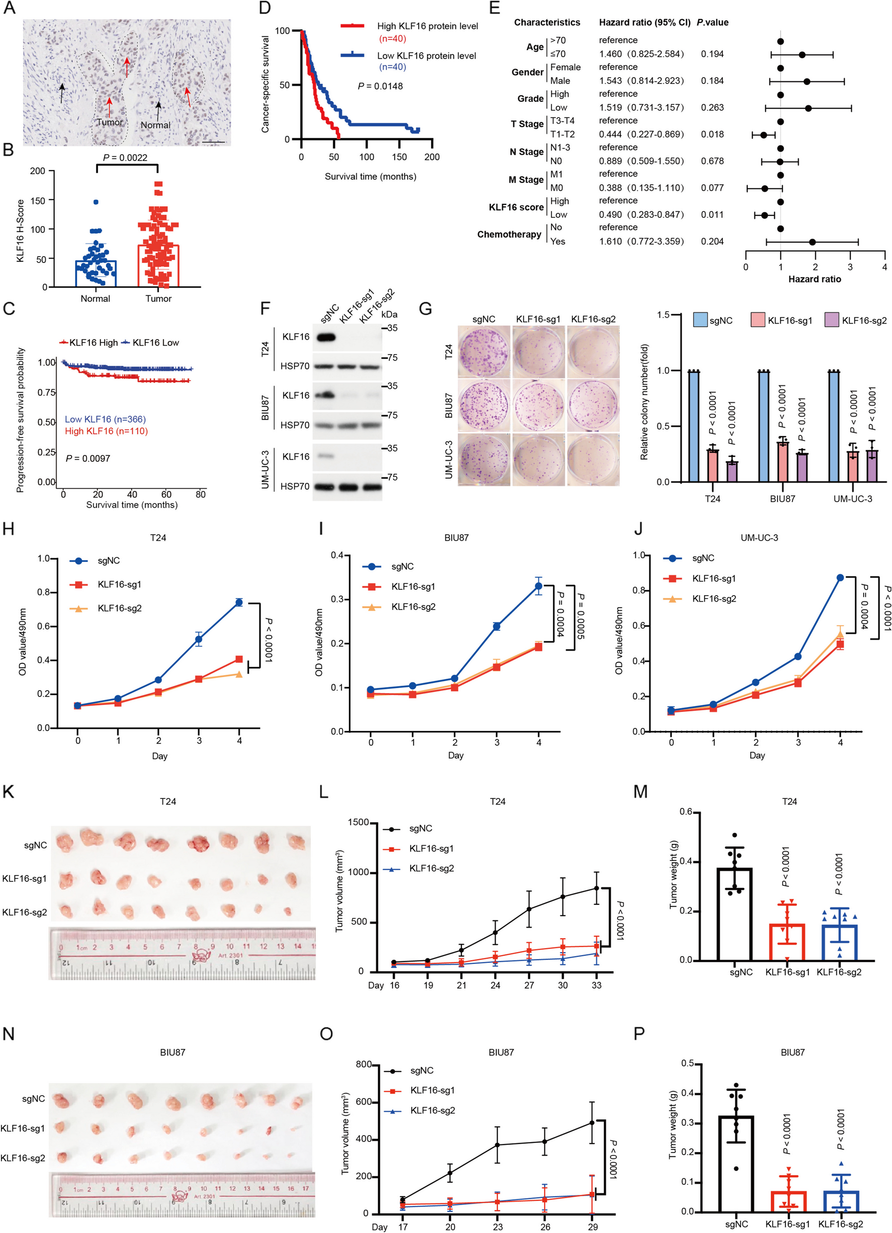 The KLF16/MYC feedback loop is a therapeutic target in bladder cancer