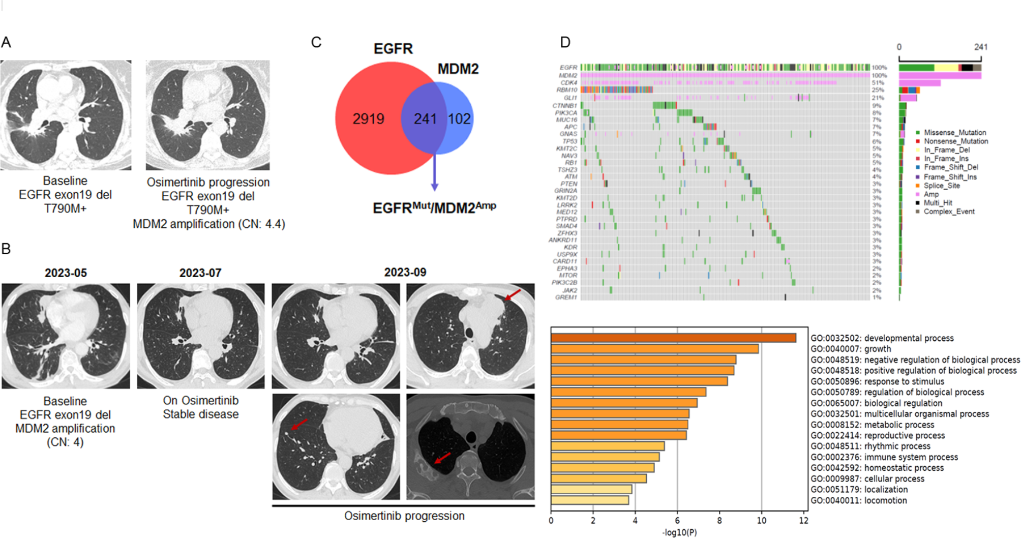 MDM2 drives resistance to Osimertinib by contextually disrupting FBW7-mediated destruction of MCL-1 protein in EGFR mutant NSCLC