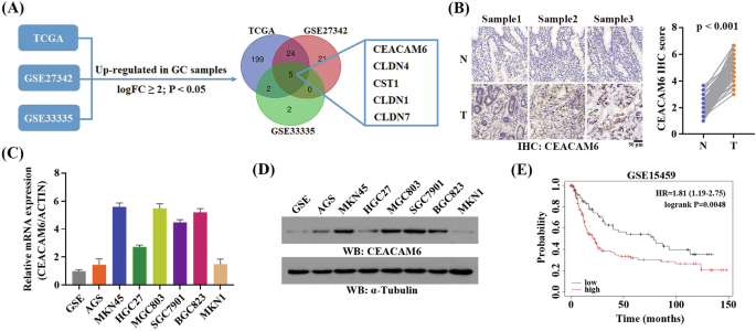 CEACAM6 facilitates gastric cancer progression through upregulating SLC27A2