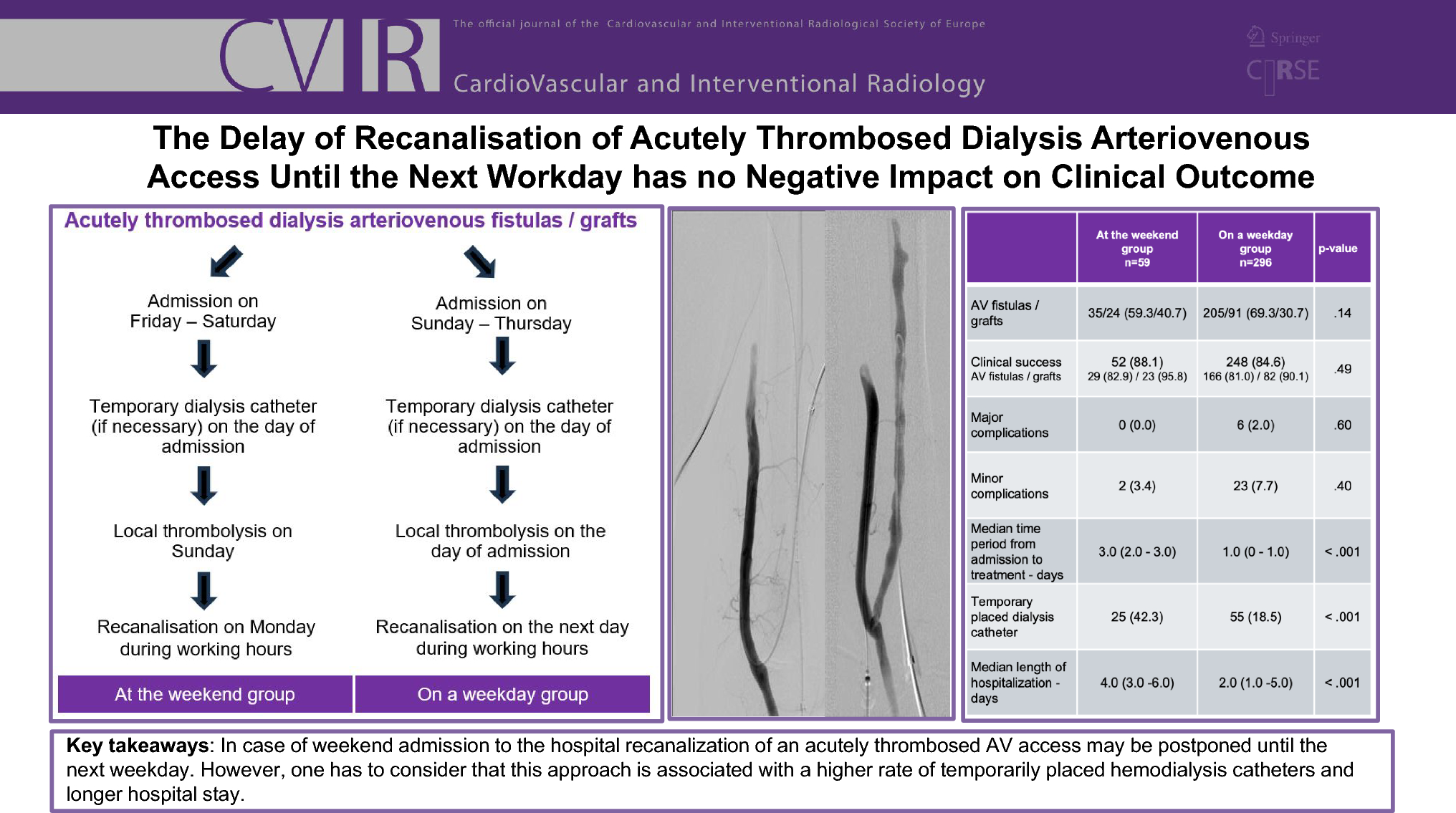 The Delay of Recanalisation of Acutely Thrombosed Dialysis Arteriovenous Access Until the Next Workday has No Negative Impact on Clinical Outcome