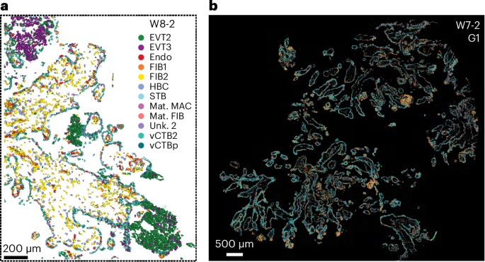 High-resolution spatial multiomic census of the human placenta