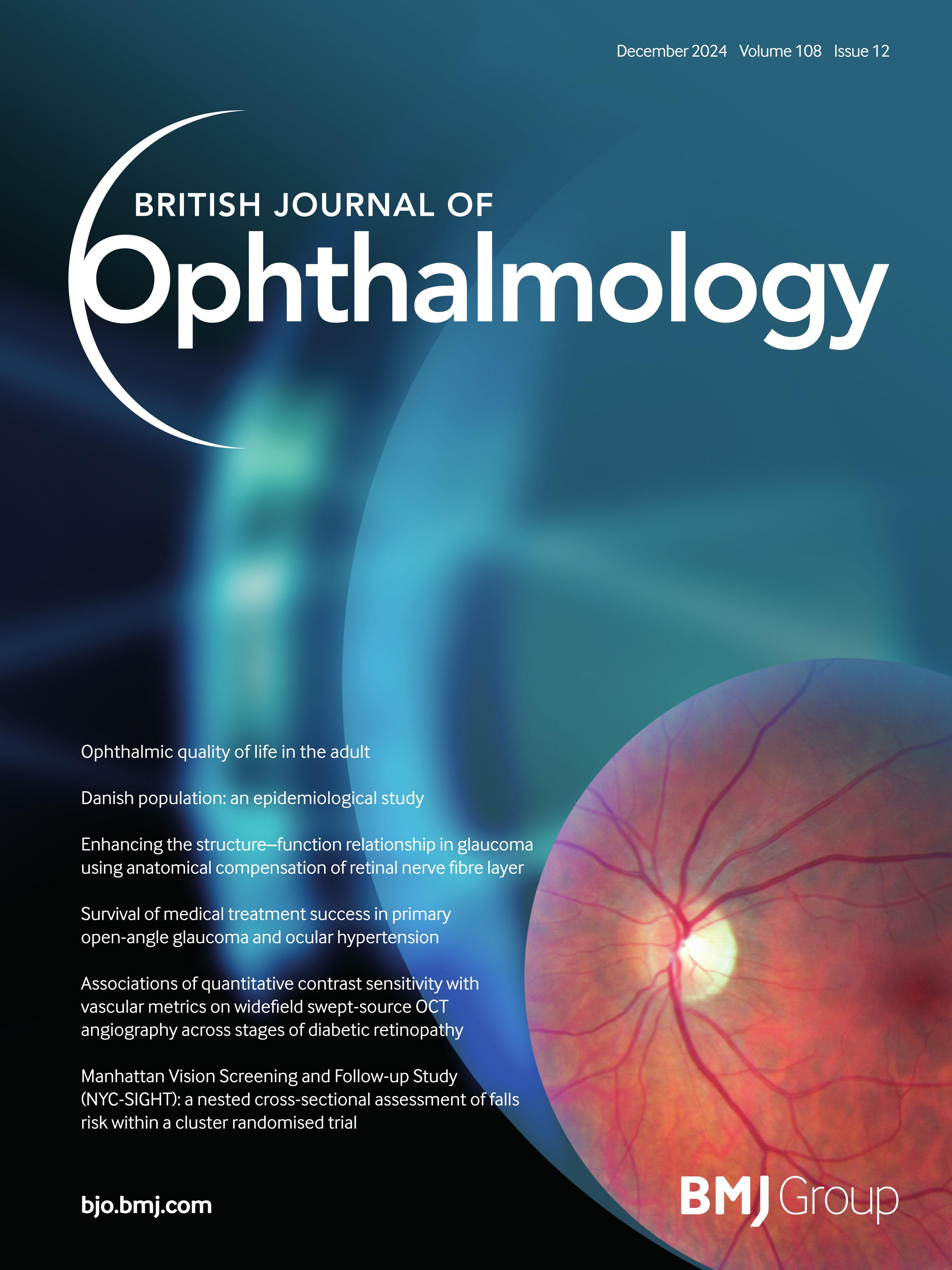 Influencing factors of effective lens position in patients with Marfan syndrome and ectopia lentis