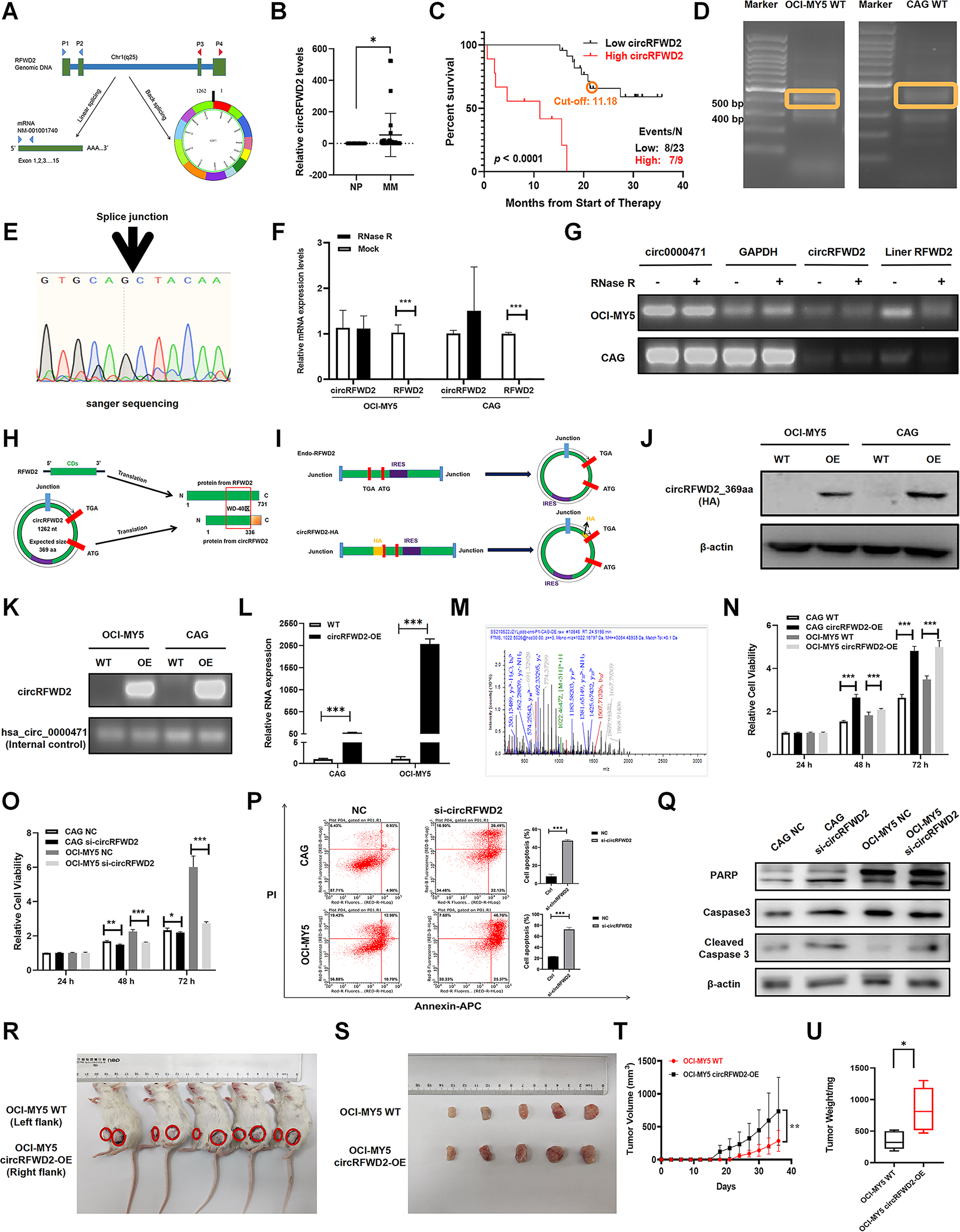 CUL4A-DDB1-circRFWD2 E3 ligase complex mediates the ubiquitination of p27 to promote multiple myeloma proliferation