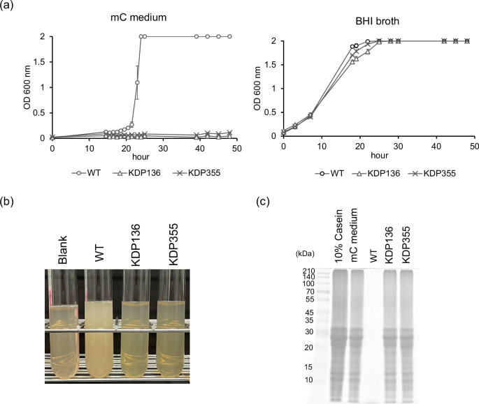 Identification of nanaomycin A and its analogs by a newly established screening method for functional inhibitors of the type IX secretion system in Porphyromonas gingivalis