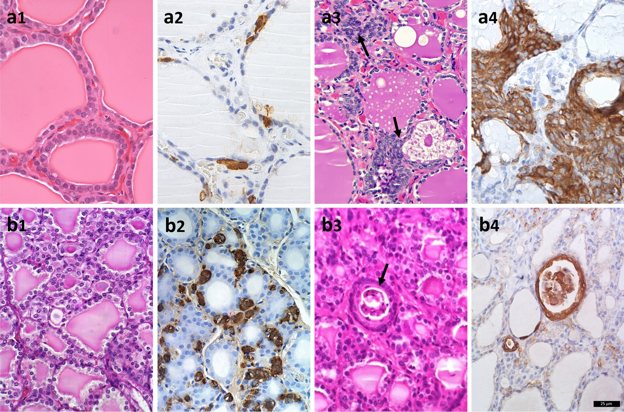 Characterization of primary cilia in different epithelial cells of thyroid gland