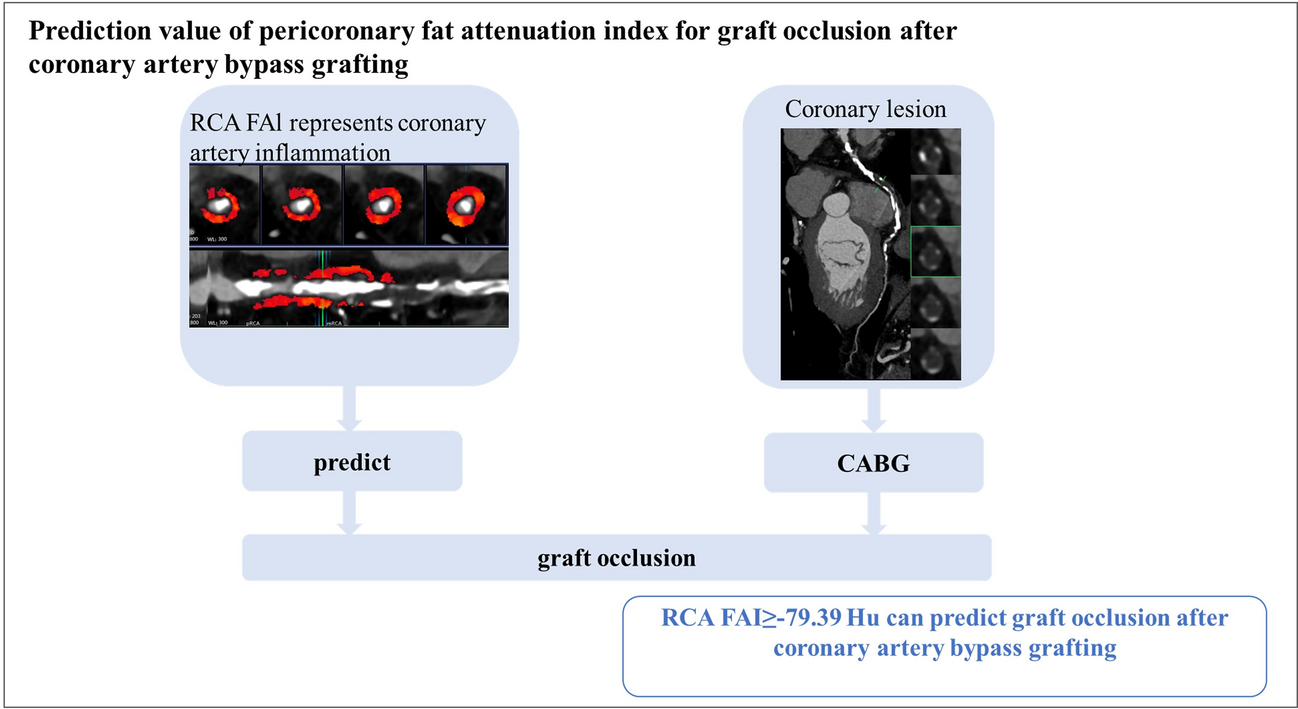 Predictive value of pericoronary fat attenuation index for graft occlusion after coronary artery bypass grafting