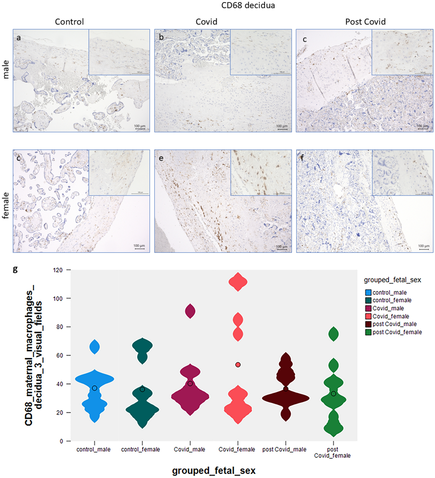 PD-L1 expression and characterization of its carrier macrophages in placentas with acute and specifically post-SARS-CoV-2 infection