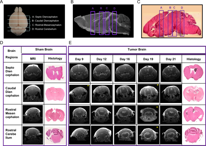 Correction: A model of breast cancer meningeal metastases: characterization with in vivo molecular imaging