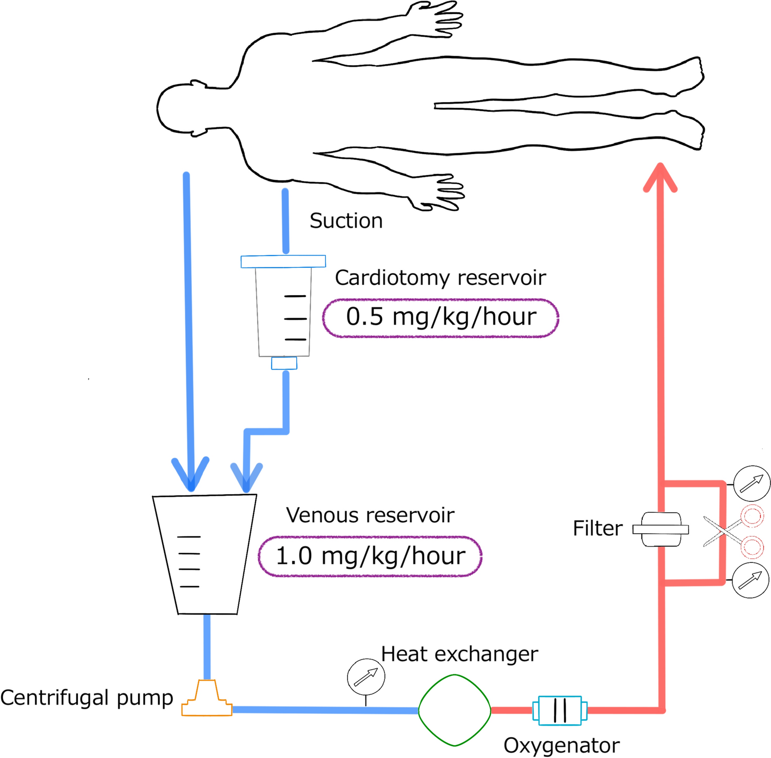 New strategy of early surgery for infective endocarditis complicated by intracranial hemorrhage