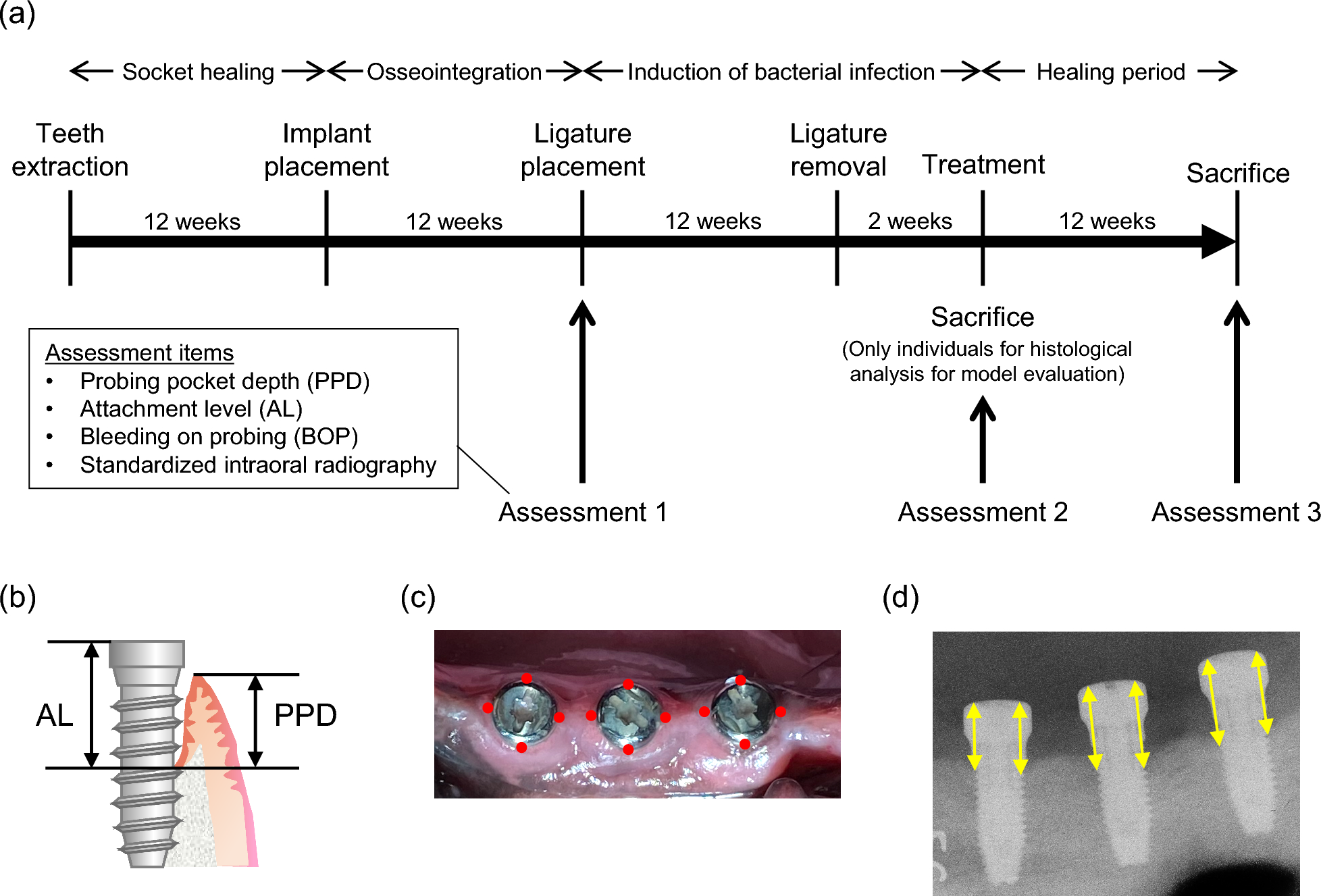 Brain-derived neurotrophic factor promotes bone regeneration in a canine model of peri-implantitis