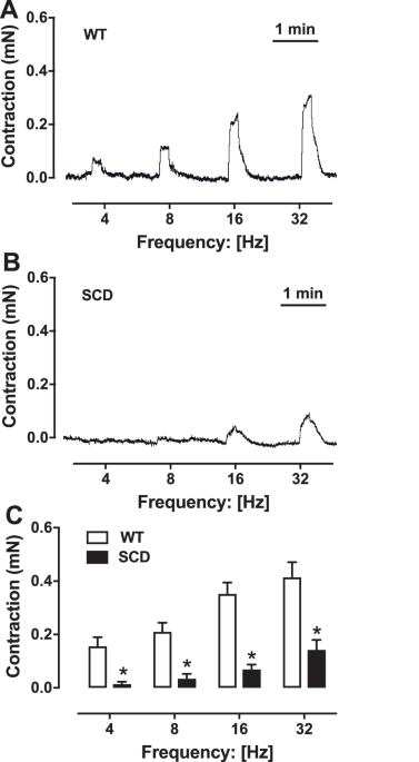 Sympathetic hypoactivity leads to hypocontractility of the corpus cavernosum in sickle cell mice: a mechanism contributing to priapism