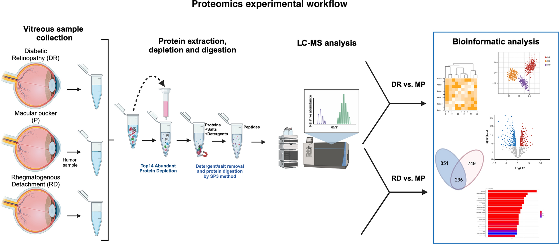 Comparative proteomic analysis of human vitreous in rhegmatogenous retinal detachment and diabetic retinopathy reveals a common pathway and potential therapeutic target