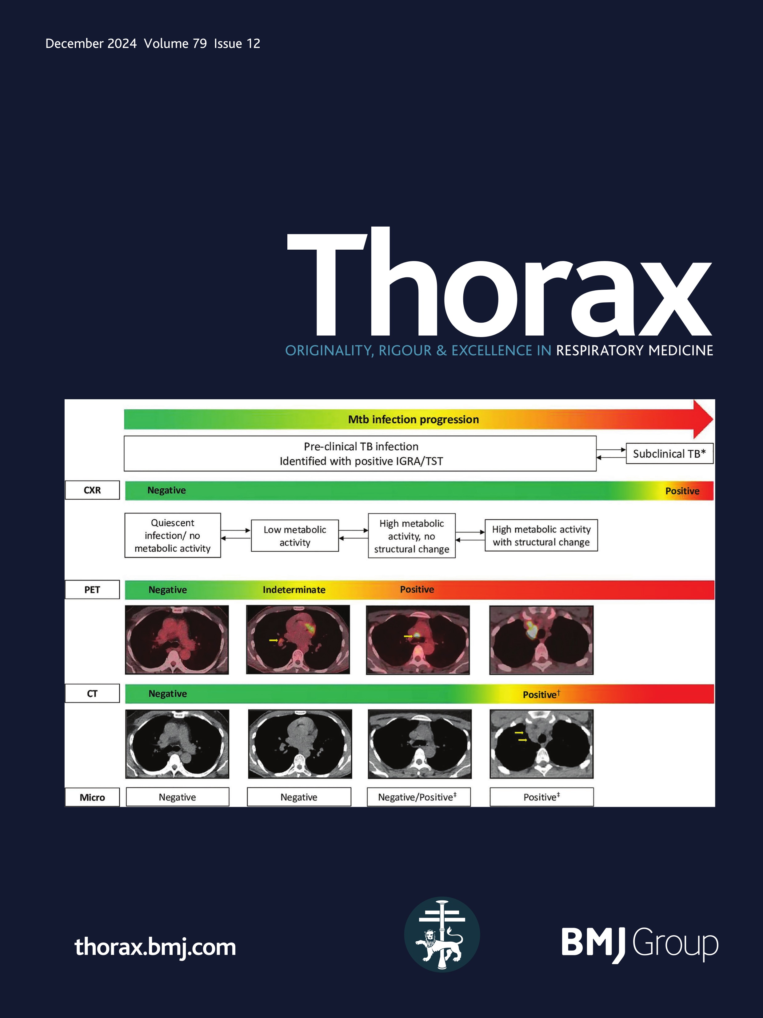 A structural and metabolic framework for classifying pre-clinical tuberculosis infection phenotypes using 18F-FDG PET-CT: a prospective cohort analysis following M. tuberculosis exposure