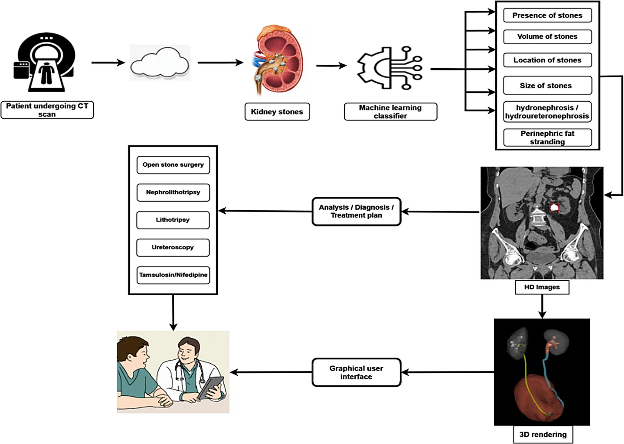 UrologiQ: AI-based accurate detection, measurement and reporting of stones in CT-KUB scans