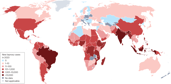 Leprosy