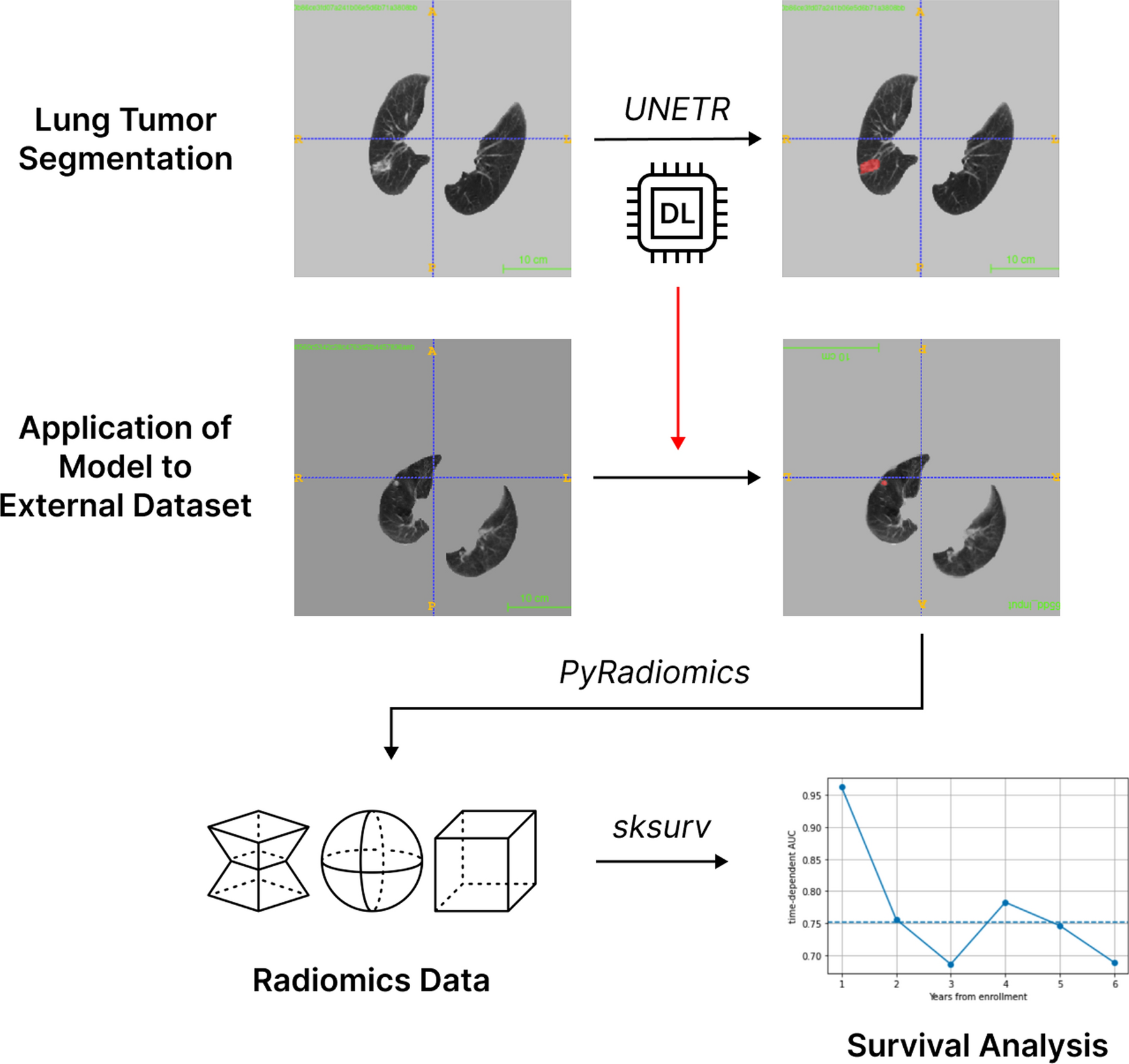 Predicting Survival and Recurrence of Lung Ablation Patients Using Deep Learning-Based Automatic Segmentation and Radiomics Analysis