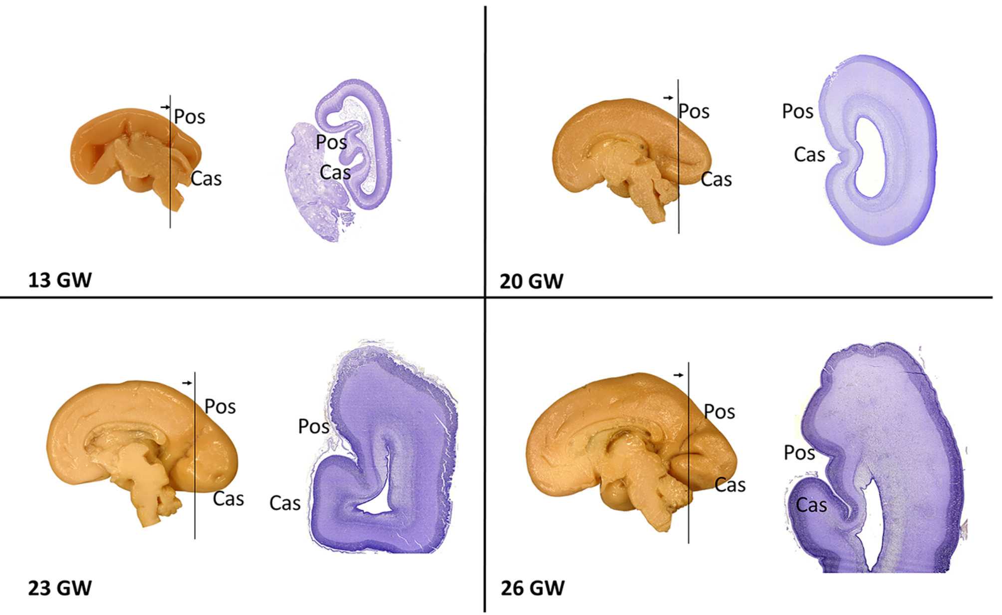 Heterogeneity in the formation of primary and secondary visual fields during human prenatal development