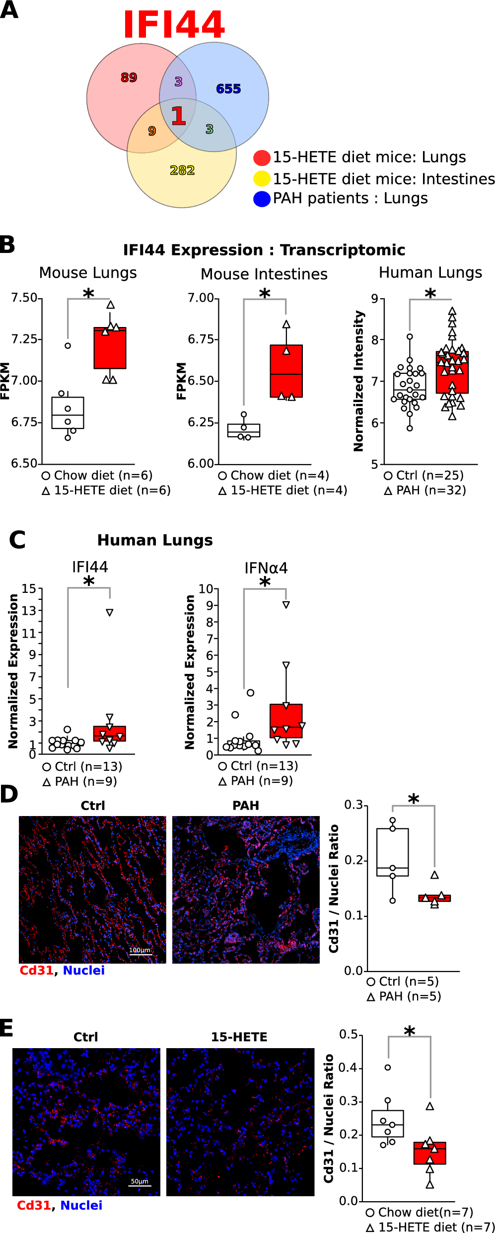 Intestinal IFNα4 promotes 15-HETE diet-induced pulmonary hypertension