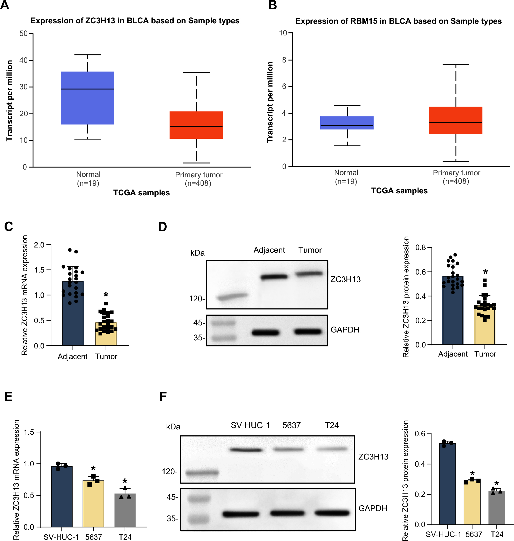 ZC3H13 promotes autophagy in bladder cancer through m6A methylation modification of PJA2 and ubiquitination of KSR1