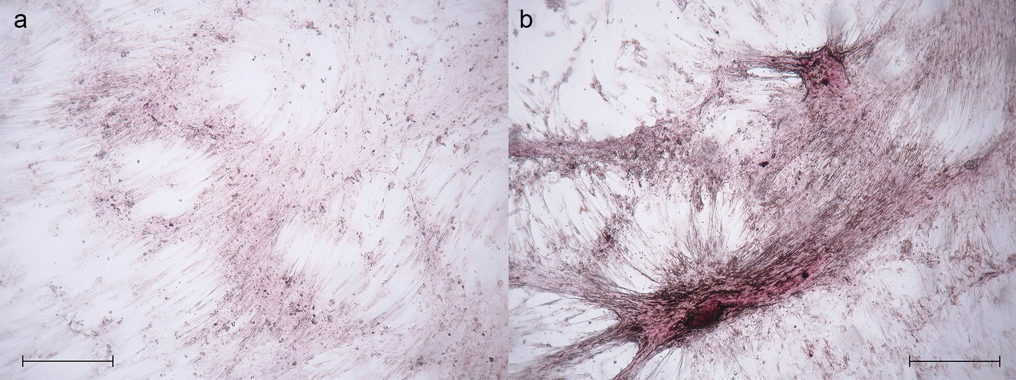 A hypothesis of mesenchymal stem cell osteogenic differentiation mediated by chelidonic acid through the calcium import: original research and computer simulation