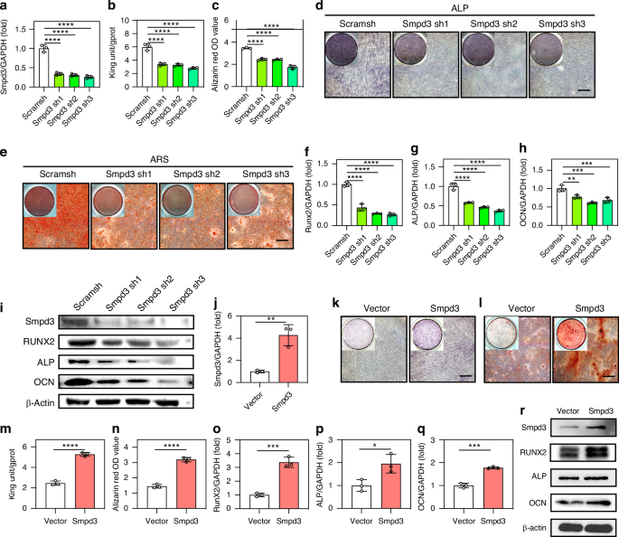 A blood glucose fluctuation-responsive delivery system promotes bone regeneration and the repair function of Smpd3-reprogrammed BMSC-derived exosomes