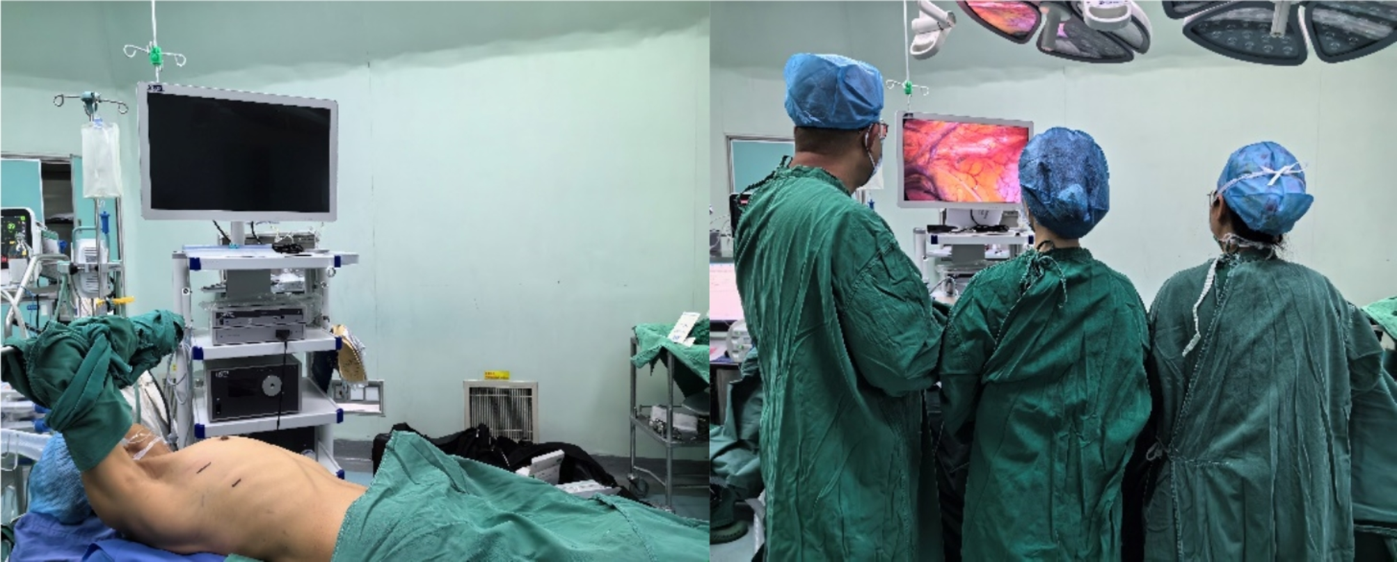 Clinical application of standardization right thoracic incision for thoracoscopic thymic tumor resection