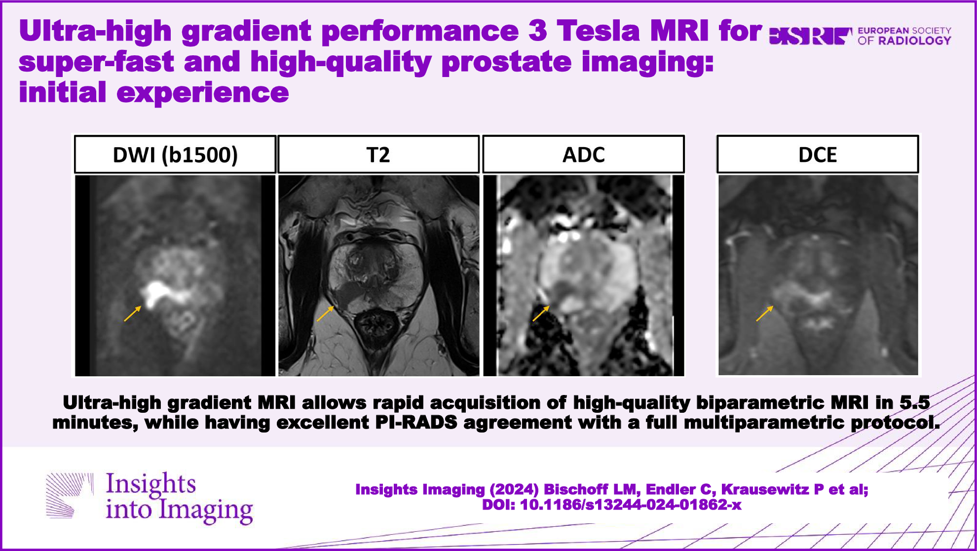 Ultra-high gradient performance 3-Tesla MRI for super-fast and high-quality prostate imaging: initial experience