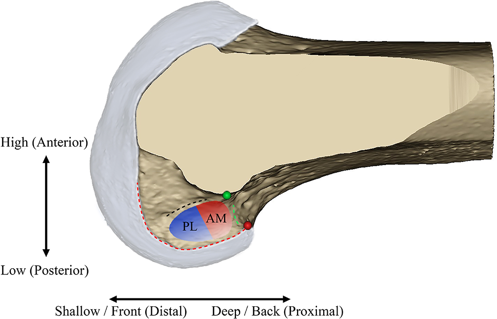 Characteristics of the femoral tunnel of anatomical and isometric single bundle anterior cruciate ligament reconstruction: a modeling analysis based on quadrant method and anatomical landmarks