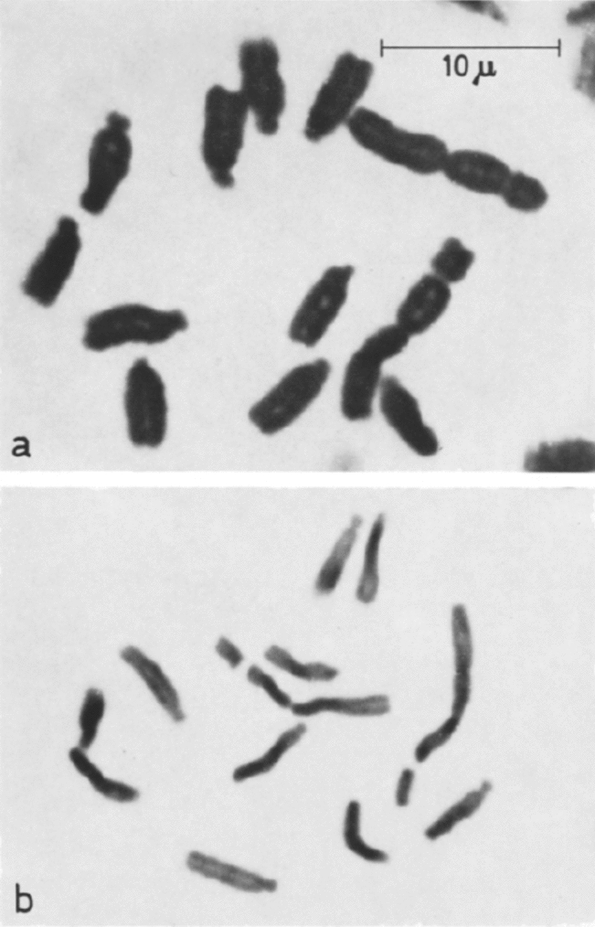 Chromosome organization: curiosity in diversity