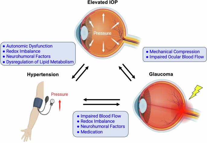 A silent interplay between elevated intraocular pressure, glaucoma, and hypertension