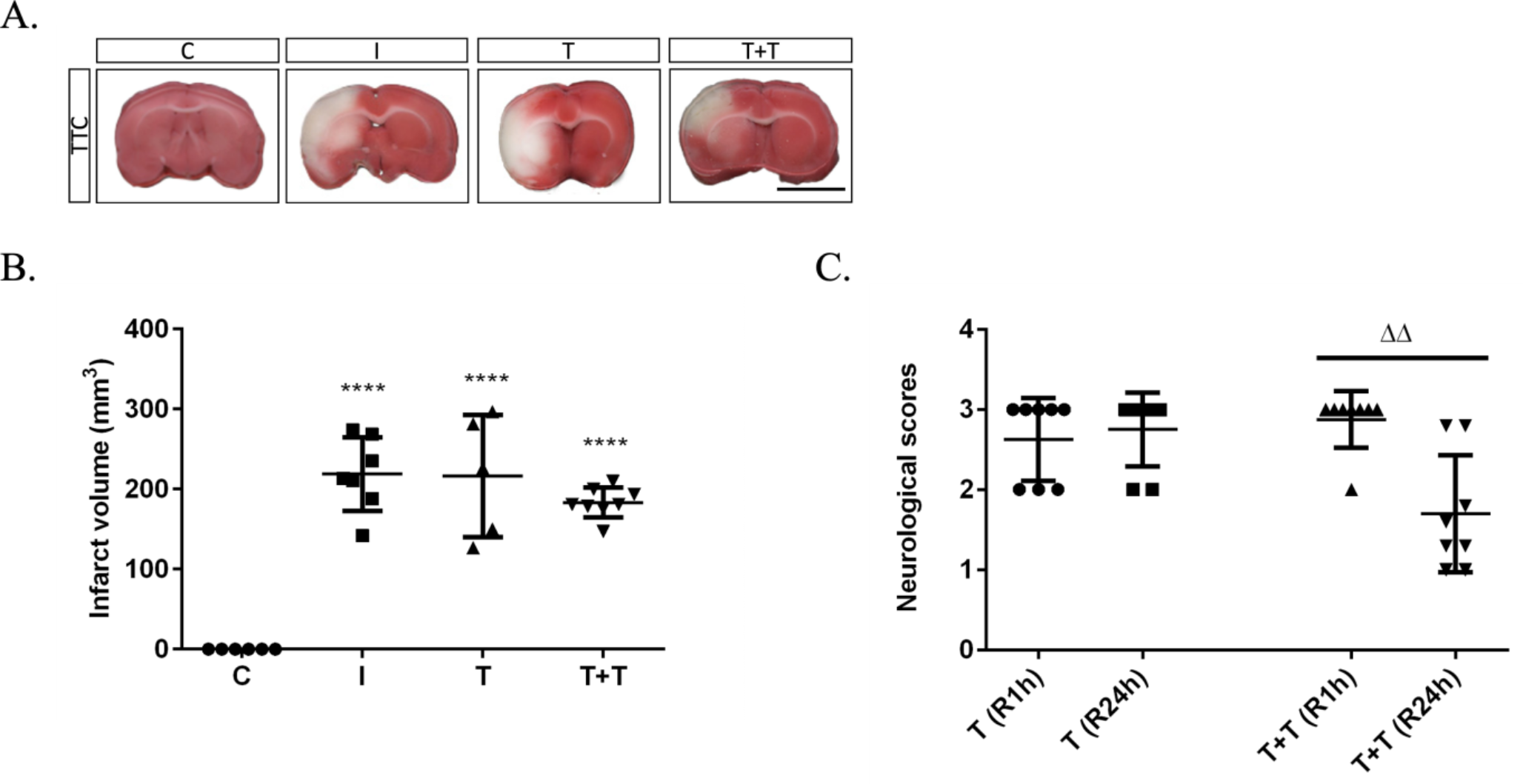 New alternative approaches to stroke treatment: the blood cell–derived secretome shows promise in individuals with obesity