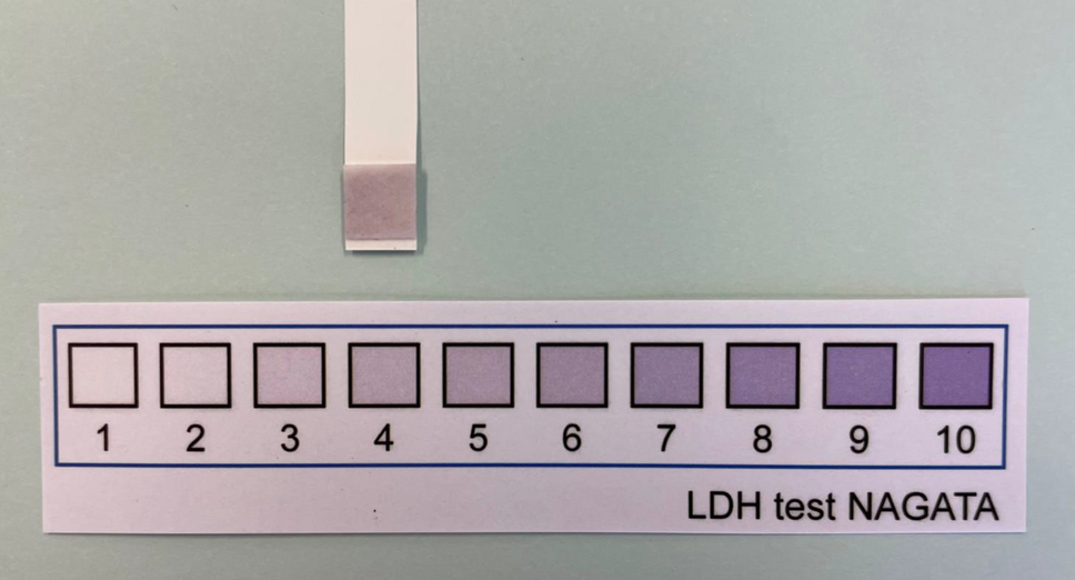 Compatibility of salivary lactate dehydrogenase level using a test kit with the community periodontal index in Japanese adults