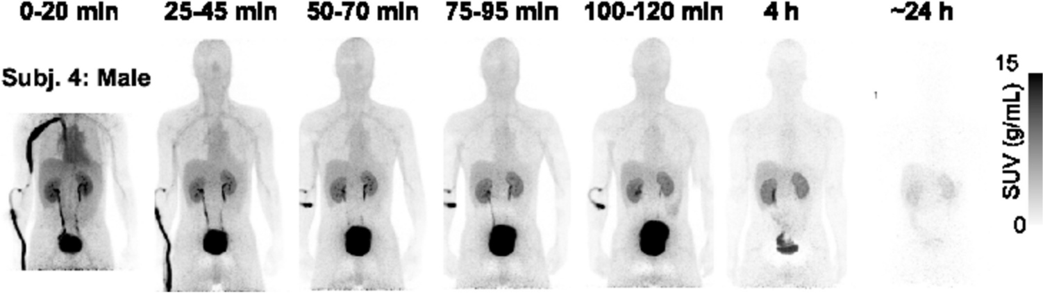 First-in-human Evaluation of Safety and Dosimetry of [64Cu]FBP8: A fibrin-binding PET Probe