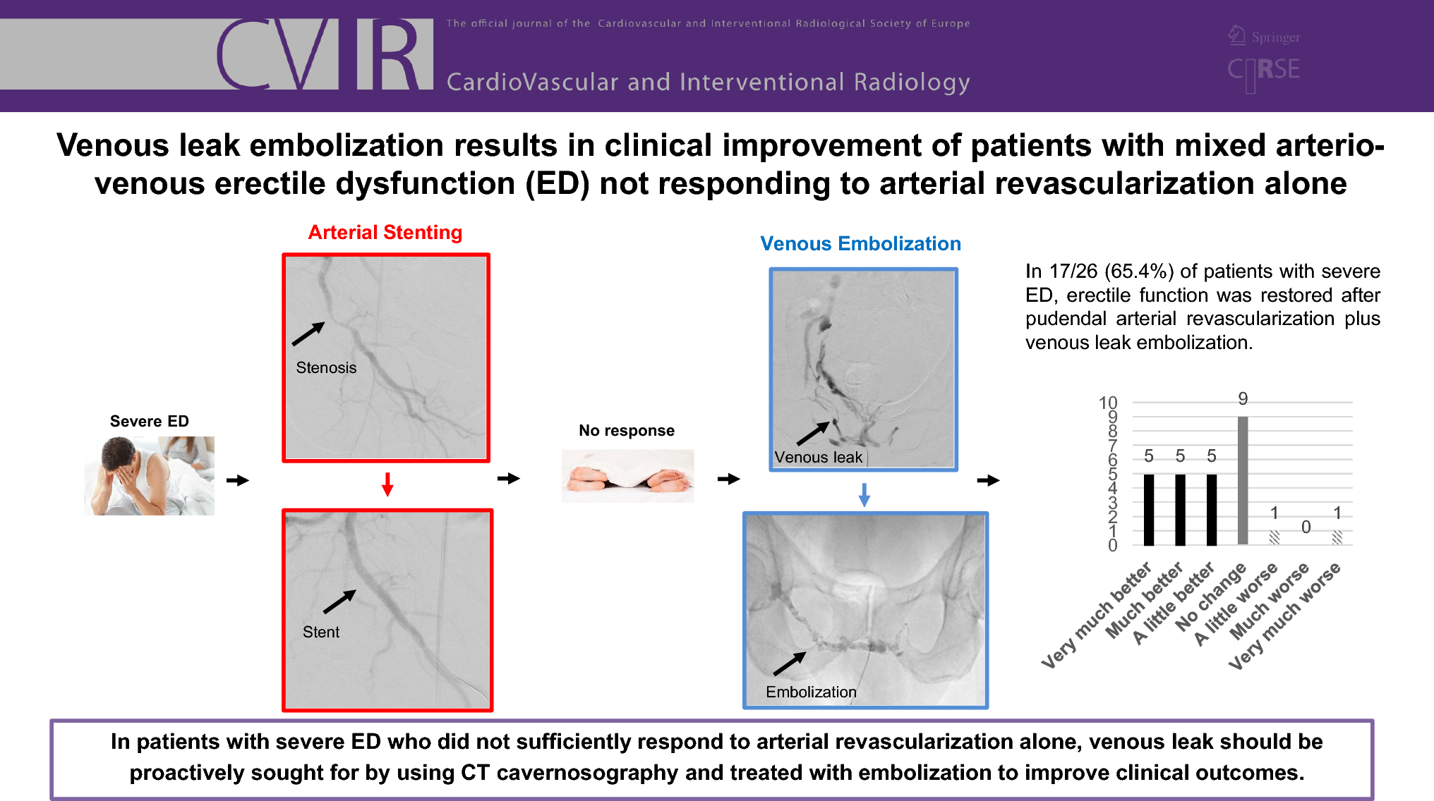 Venous Leak Embolization Results in Clinical Improvement of Patients with Mixed Arterio-Venous Erectile Dysfunction Not Responding to Arterial Revascularization Alone