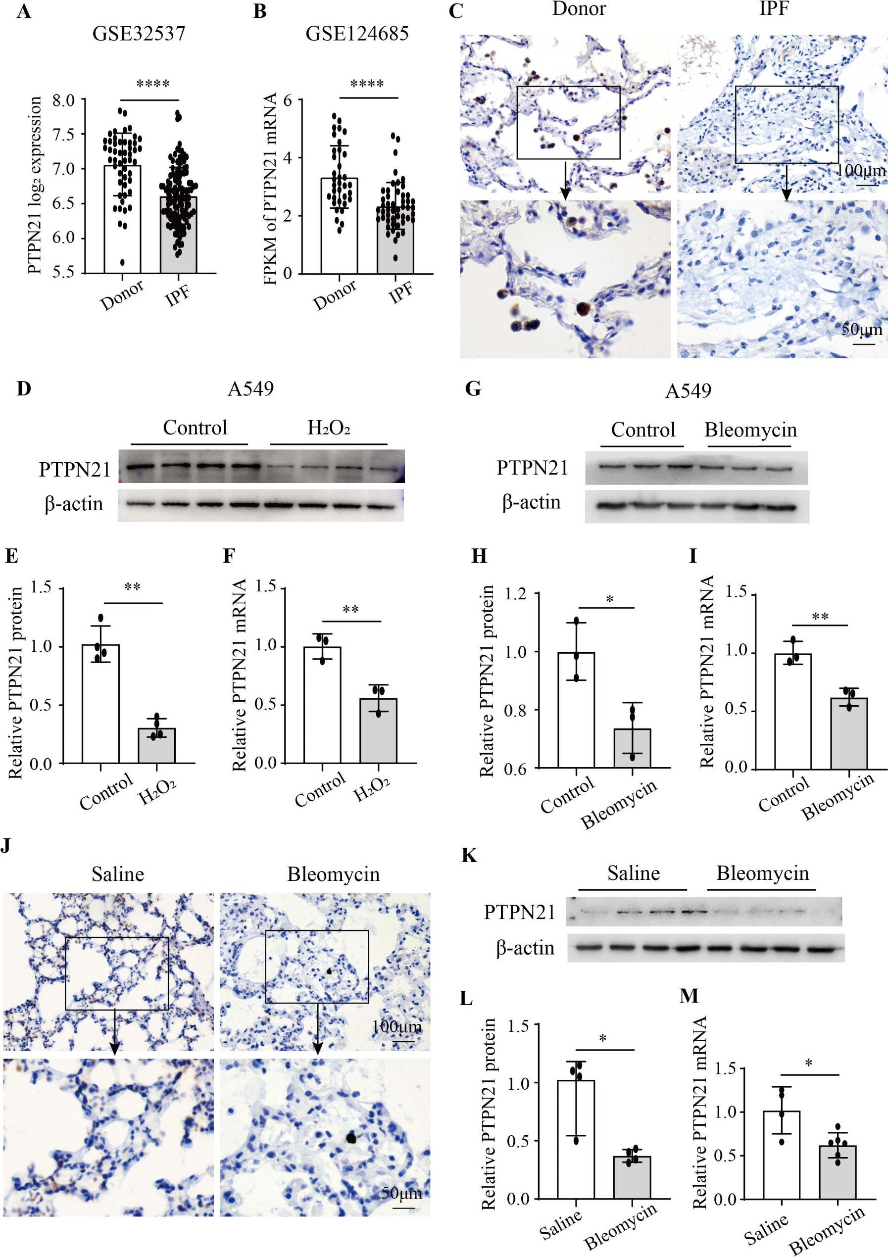 Loss of PTPN21 disrupted mitochondrial metabolic homeostasis and aggravated experimental pulmonary fibrosis