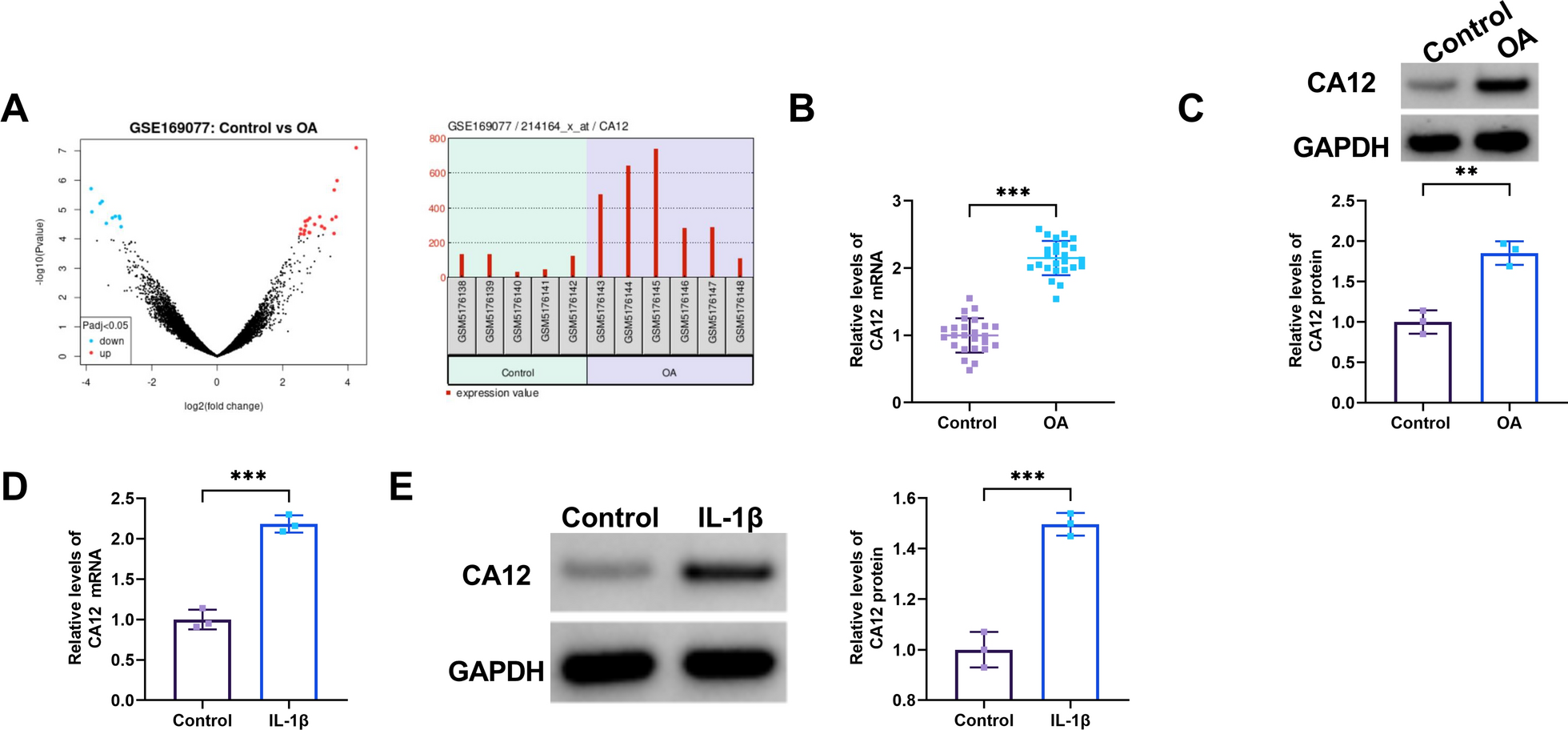 WTAP mediates IL-1β-induced chondrocyte injury by enhancing CA12 mRNA stability depending on m6A modification