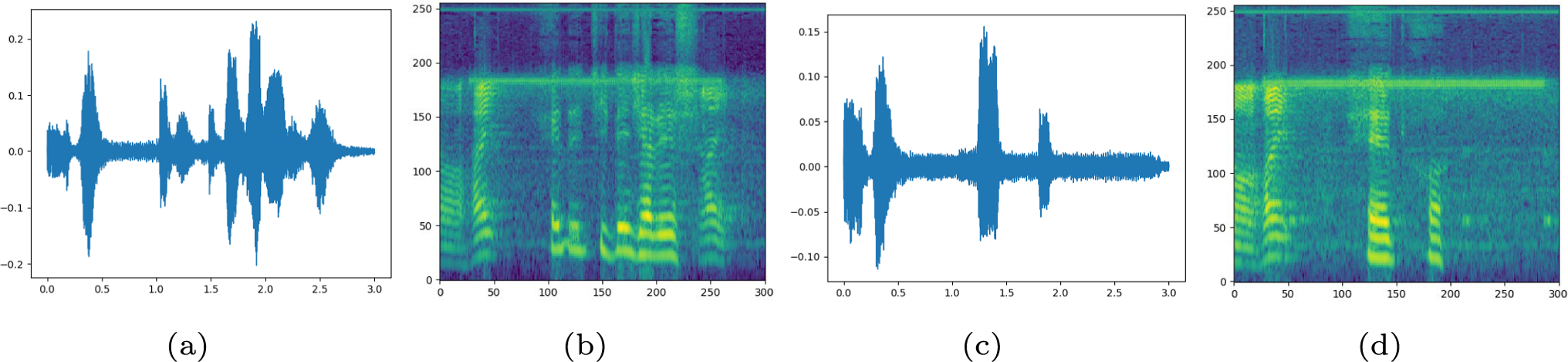 Classification of speech arrests and speech impairments during awake craniotomy: a multi-databases analysis