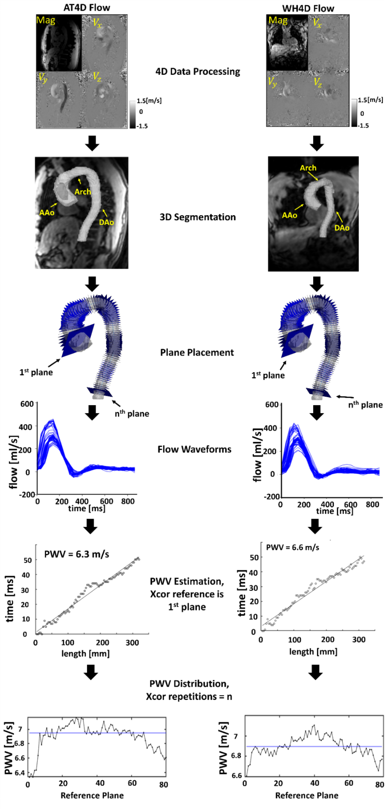 Robustness of 4D flow MRI derived aortic wall shear stress and pulse wave velocity across different protocols in healthy controls and in patients with bicuspid aortic valve