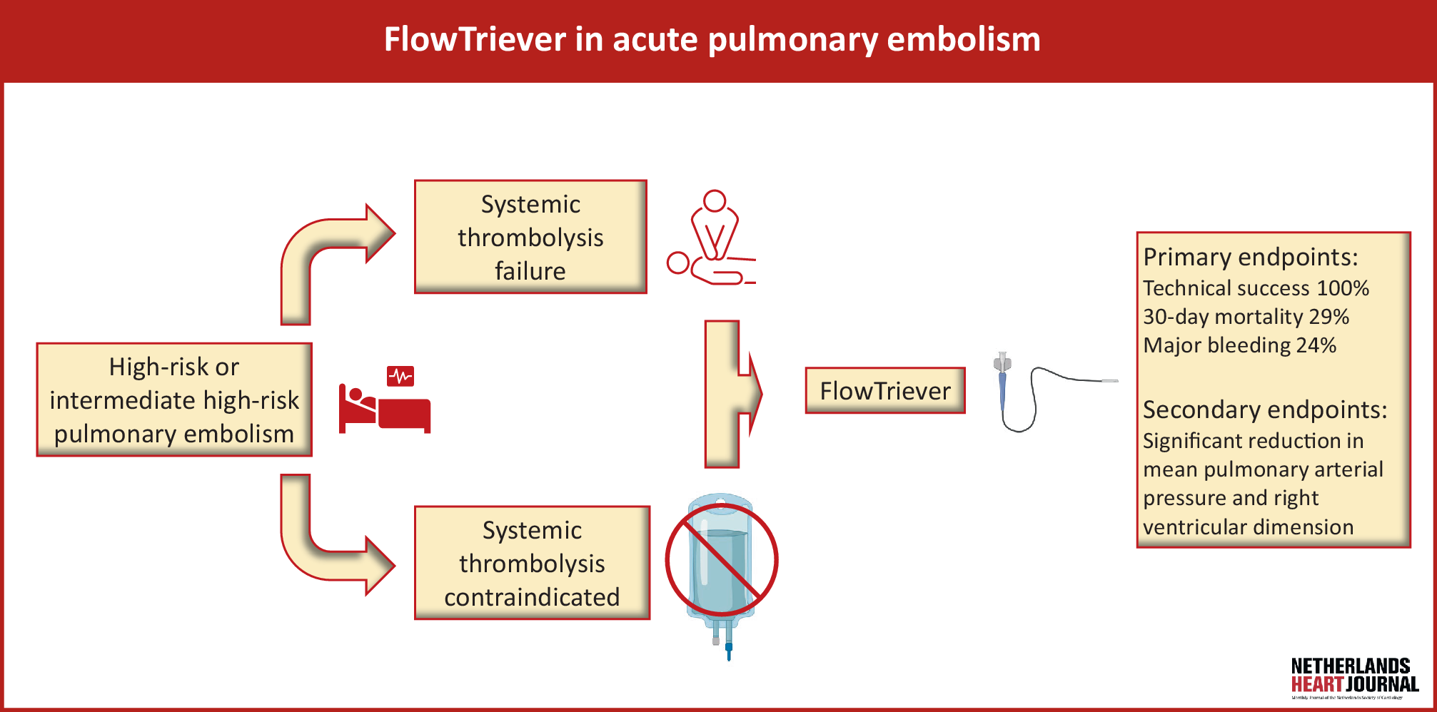 Catheter-directed therapy with the FlowTriever system for intermediate-high and high-risk pulmonary embolism: a single-centre experience