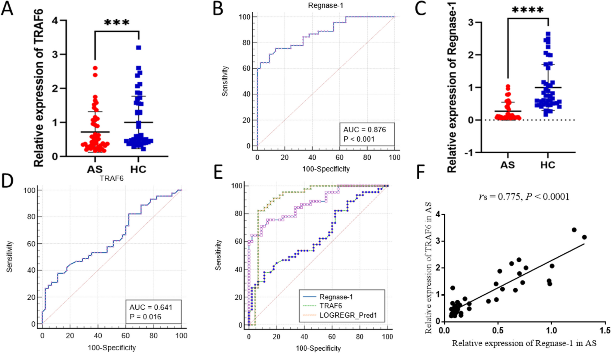 Regnase-1 regulates inflammation in T cells of ankylosing spondylitis through the TRAF6