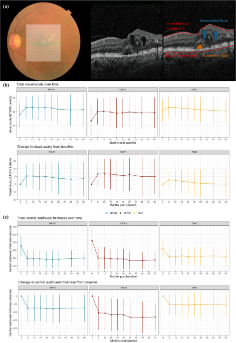 Visual and anatomical failure of anti-VEGF therapy for retinal vascular diseases: a survival analysis of real-world data