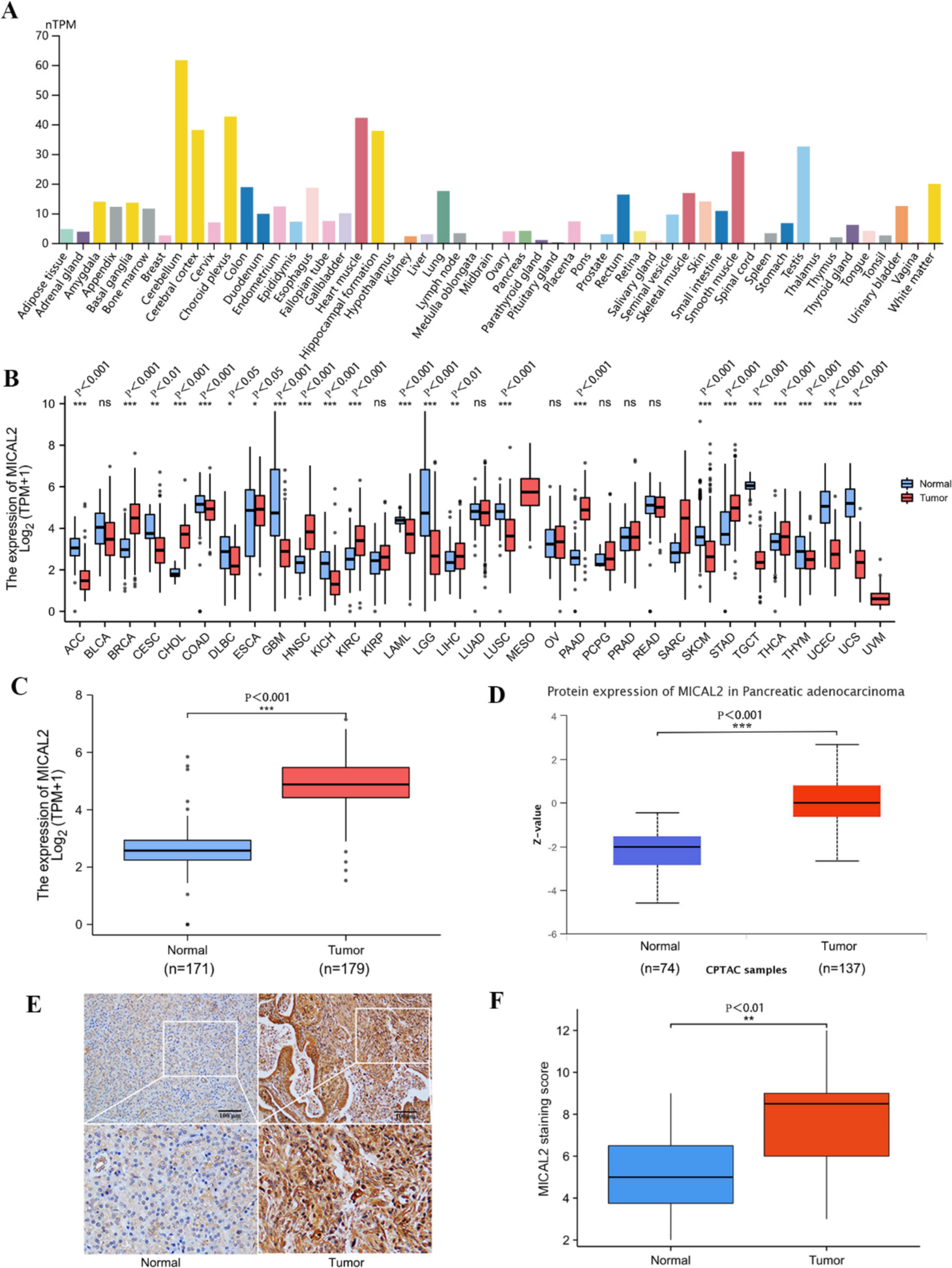 Prognostic biomarker MICAL2 and associates with proliferation, migration and immune infiltration in pancreatic adenocarcinoma