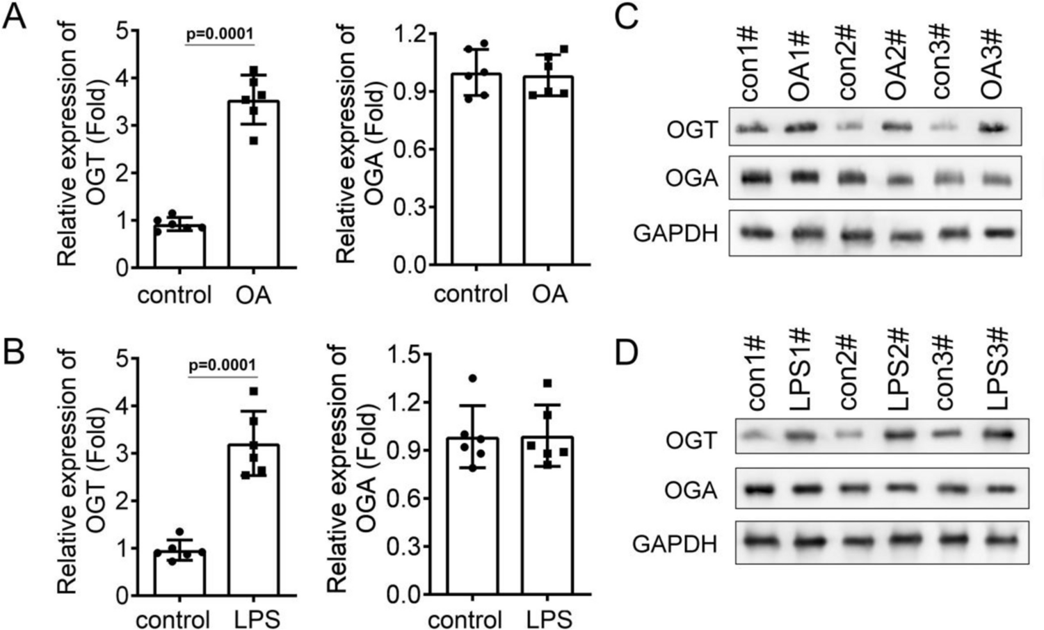 OGT promotes the ferroptosis of chondrocytes in osteoarthritis development via O-GlcNAcylation modification of ACSF2