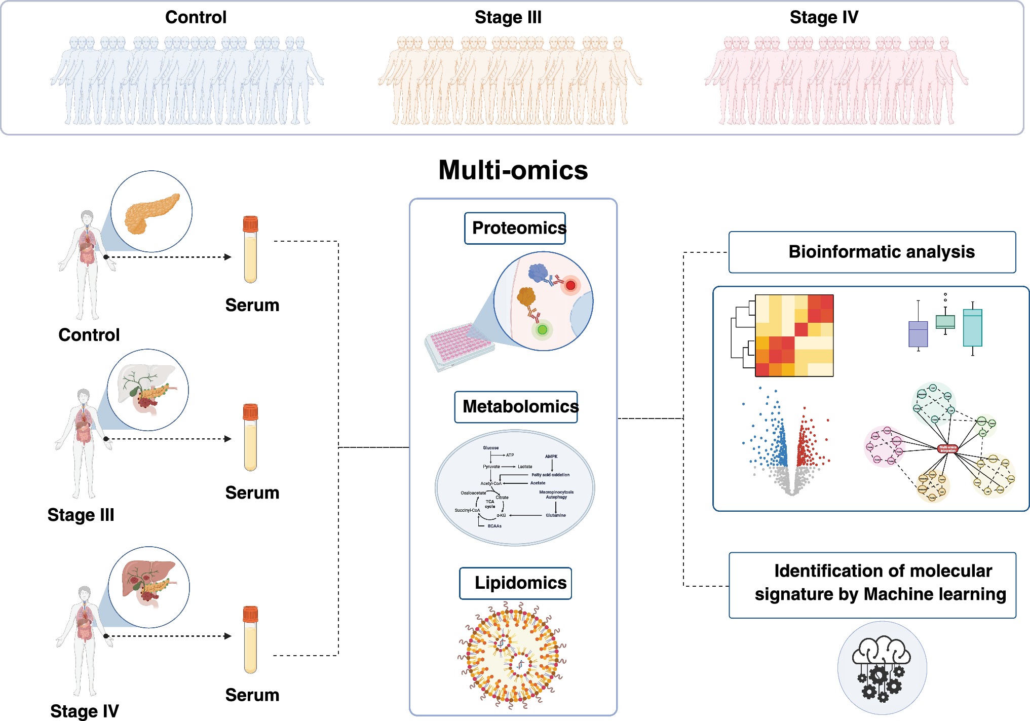 An integrative multi-omics analysis reveals a multi-analyte signature of pancreatic ductal adenocarcinoma in serum