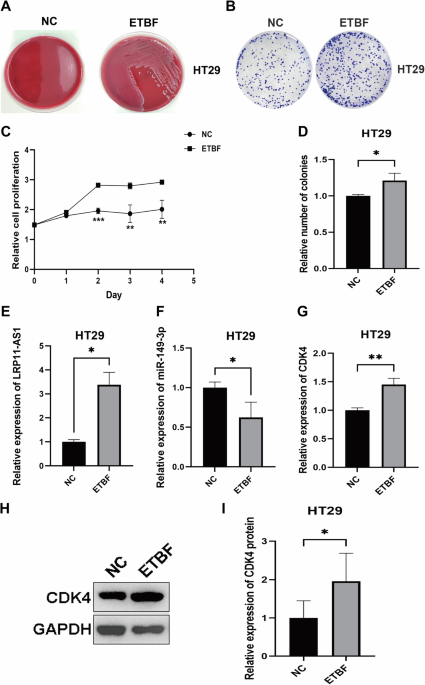 LRP11-AS1 mediates enterotoxigenic Bacteroides fragilis-related carcinogenesis in colorectal Cancer via the miR-149-3p/CDK4 pathway