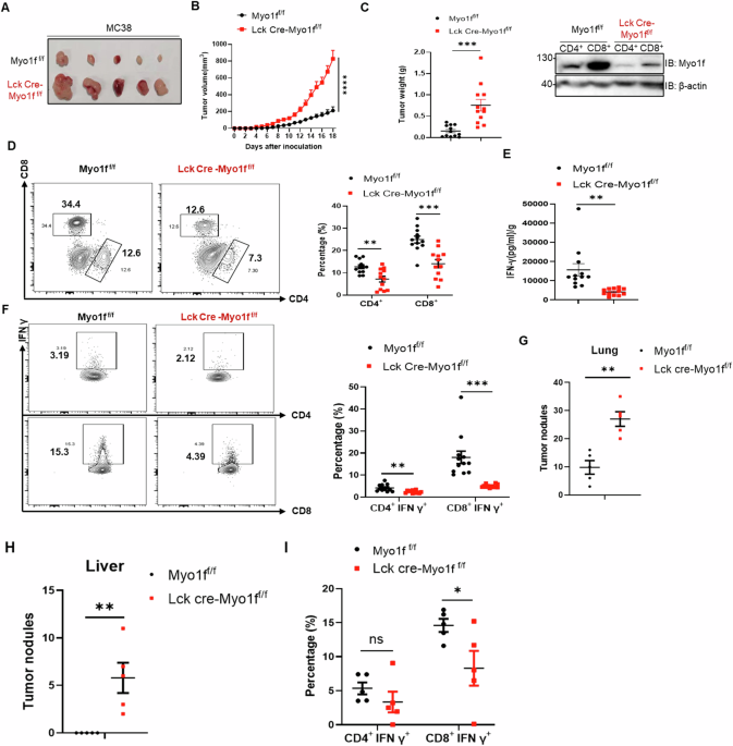 MYO1F regulates T-cell activation and glycolytic metabolism by promoting the acetylation of GAPDH