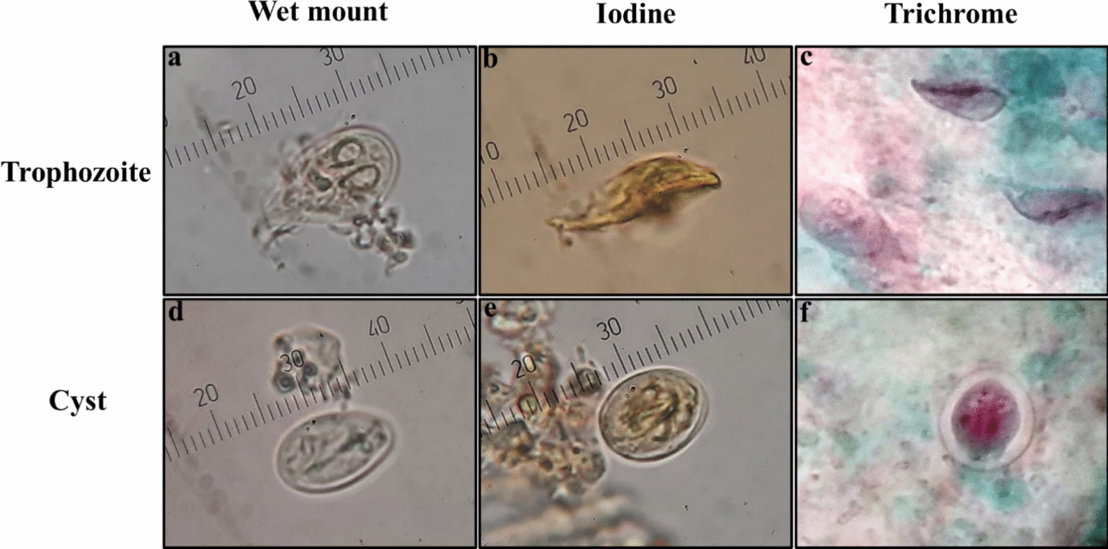 Molecular characterization and risk analysis of Giardia duodenalis assemblages in corticosteroid-treated and non-treated patients in Ismailia, Arab Republic of Egypt