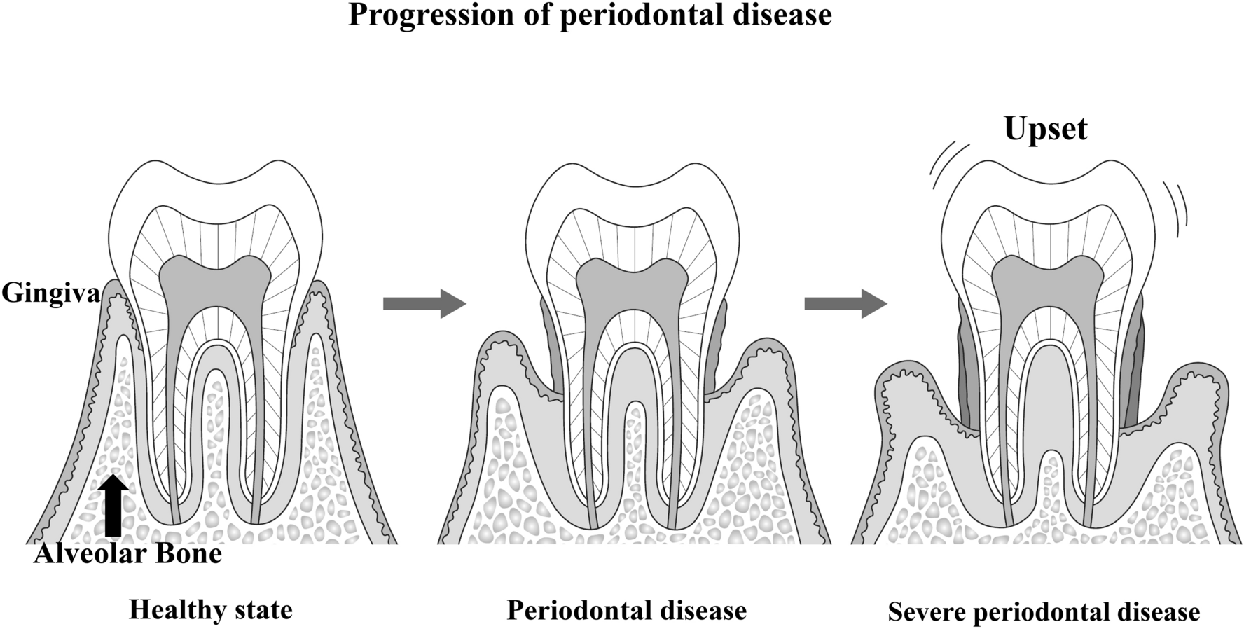 Recent findings on metabolomics and the microbiome of oral bacteria involved in dental caries and periodontal disease